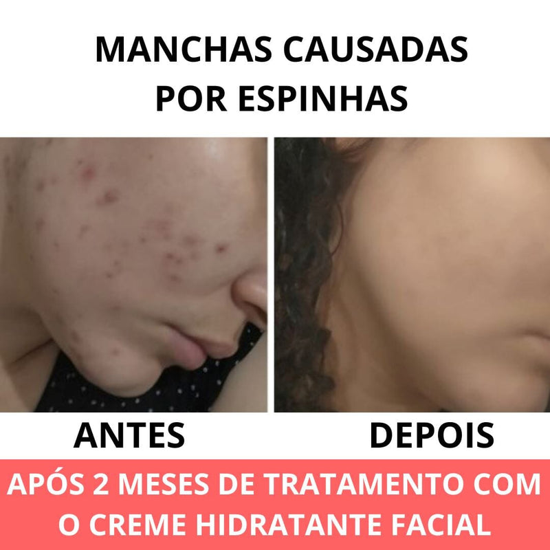 Creme Hidratante Facial Anti Rugas Cuidados Pessoais Anti Idade